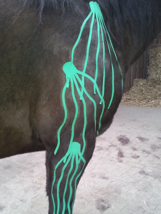 Lymph-Tape